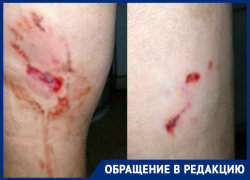 70-летнего пенсионера погрызли бойцовские собаки на Ставрополье 70-летнего пенсионера погрызли бойцовские собаки на Ставрополье
