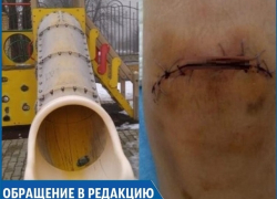 «Из-за поломанной горки сын травмировал ногу, рана 13 сантиметров!» - ставропольчанка «Из-за поломанной горки сын травмировал ногу, рана 13 сантиметров!» - ставропольчанка