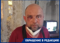 Водителя скорой помощи в Невинномысске избили после конфликта с диспетчером Водителя скорой помощи в Невинномысске избили после конфликта с диспетчером