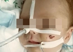 "Перед глазами стоит монитор с этим звуком. Мой сын прожил и промучался 40 дней", - жительница Ставрополья "Перед глазами стоит монитор с этим звуком. Мой сын прожил и промучался 40 дней", - жительница Ставрополья