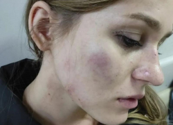 В Михайловске неизвестный жестоко избил девушку в 50-ти метрах от дома В Михайловске неизвестный жестоко избил девушку в 50-ти метрах от дома