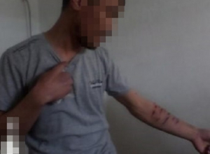 Отказавшийся повиноваться арестант изрезал себе руки лезвием в знак протеста на Ставрополье Отказавшийся повиноваться арестант изрезал себе руки лезвием в знак протеста на Ставрополье