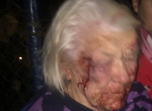Появились подробности страшного избиения 89-летней ветерана ВОВ молодым мужчиной на Ставрополье Появились подробности страшного избиения 89-летней ветерана ВОВ молодым мужчиной на Ставрополье