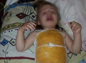 Двухлетняя девочка получила ожоги в детском саду Буденновска Двухлетняя девочка получила ожоги в детском саду Буденновска