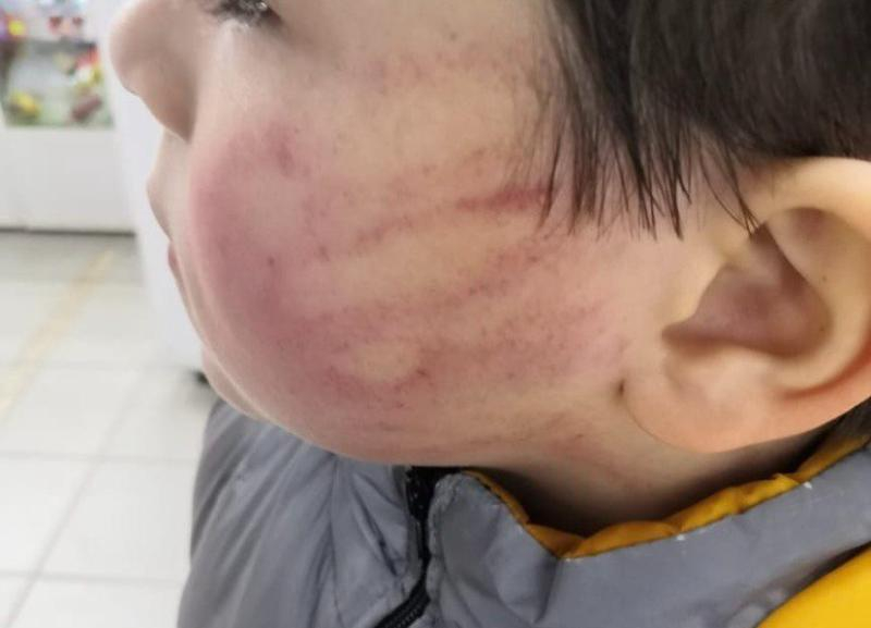 В Георгиевске судьбу избившей мальчика воспитательницы будет решать суд В Георгиевске судьбу избившей мальчика воспитательницы будет решать суд