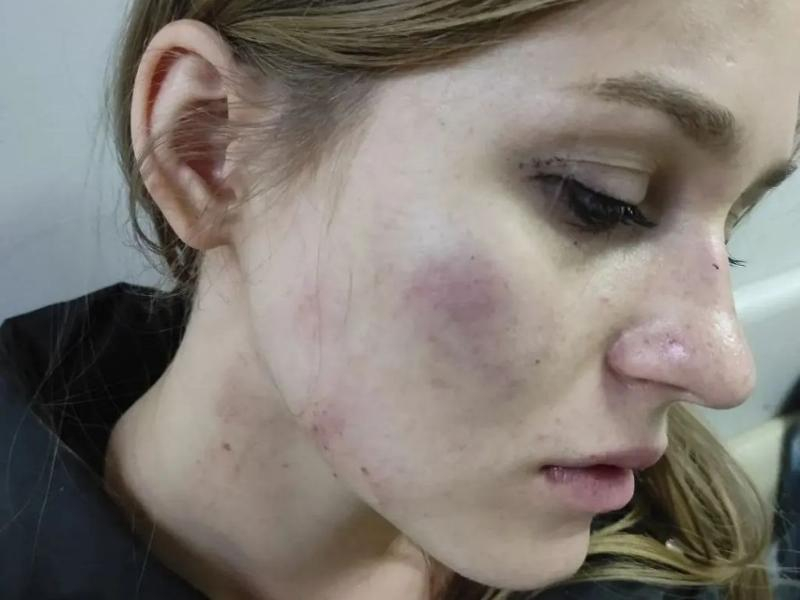 В Михайловске неизвестный жестоко избил девушку в 50-ти метрах от дома В Михайловске неизвестный жестоко избил девушку в 50-ти метрах от дома
