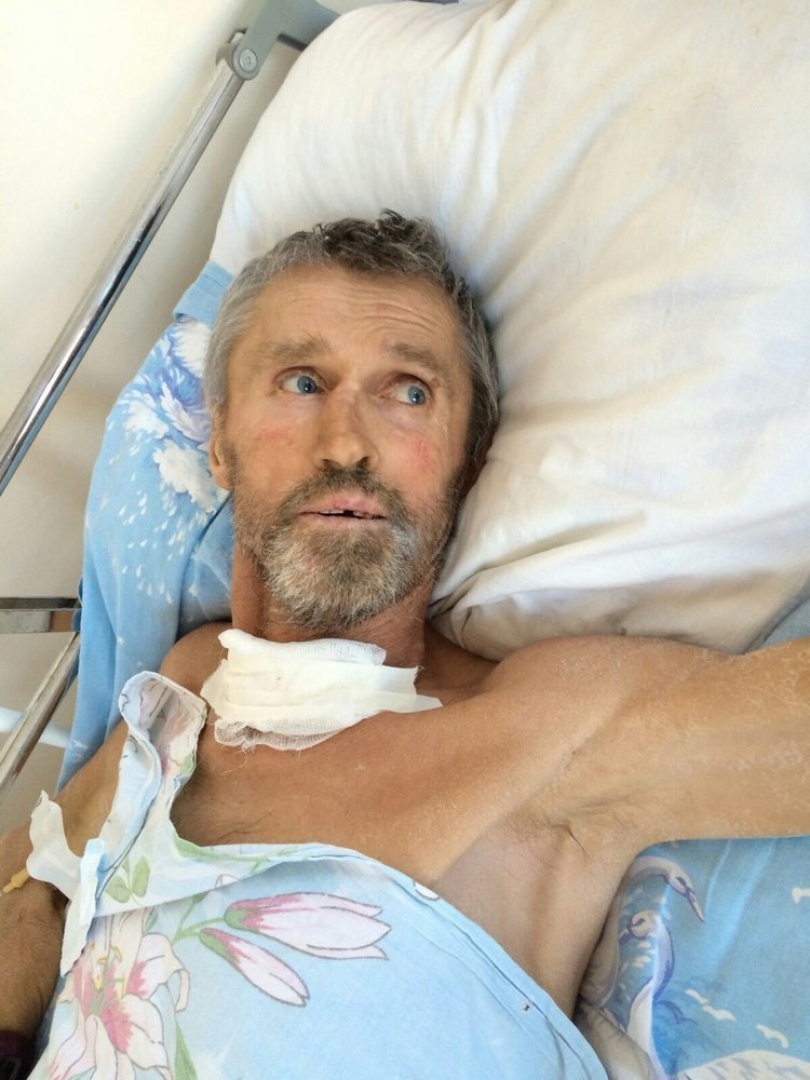 В Ставрополе мужчина потерял память после инсульта и комы